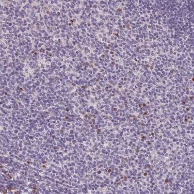 Immunohistochemistry-Paraffin: FCRL3/FcRH3 Antibody [NBP2-62615]