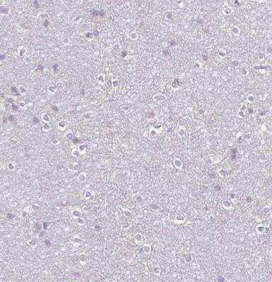 Immunohistochemistry-Paraffin: FCRL3/FcRH3 Antibody [NBP2-62615]