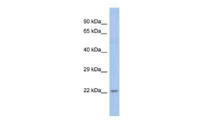 Western Blot: FCRL3/FcRH3 Antibody [NBP3-09272]