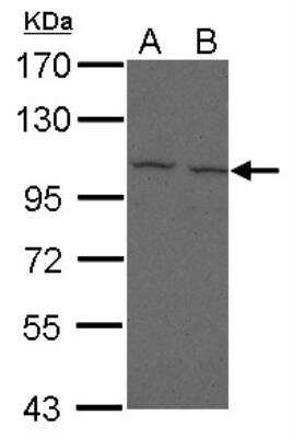 Western Blot: FCRL5/FcRH5/IRTA2 Antibody [NBP2-16994]