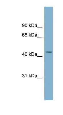 Western Blot: FCRL6/FcRH6 Antibody [NBP1-91578]