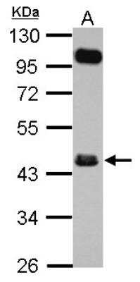 Western Blot: FCRLA/FCRLM1 Antibody [NBP2-16462]