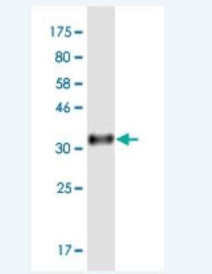 Western Blot: FCRLB/FCRY Antibody (2F8) [H00127943-M01-100ug]