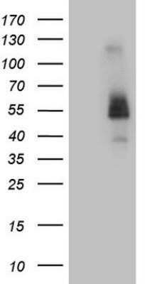 Western Blot: FCRLB/FCRY Antibody (OTI5H6)Azide and BSA Free [NBP2-72384]