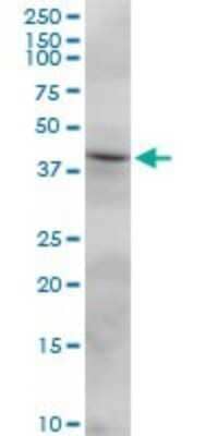 Western Blot: FCRLB/FCRY Antibody [H00127943-B01P]