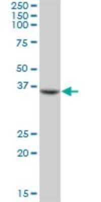 Western Blot: FCRLB/FCRY Antibody [H00127943-B01P]