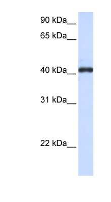 Western Blot: FCRLA/FCRLM1 Antibody [NBP1-62325]