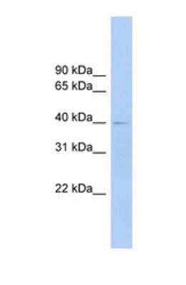 Western Blot: FCRLA/FCRLM1 Antibody [NBP1-69347]