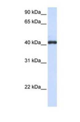 Western Blot: FCRLA/FCRLM1 Antibody [NBP1-69351]