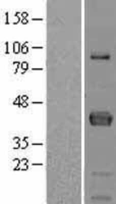 Western Blot: FCRLA/FCRLM1 Overexpression Lysate [NBL1-10666]