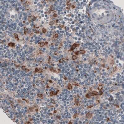 Immunohistochemistry-Paraffin: FCRN/FCGRT Antibody (CL3638) [NBP2-61626]