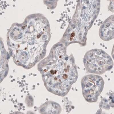 Immunohistochemistry-Paraffin: FCRN/FCGRT Antibody (CL3638) [NBP2-61626]