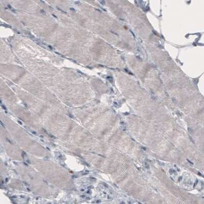 Immunohistochemistry-Paraffin: FCRN/FCGRT Antibody (CL3638) [NBP2-61626]