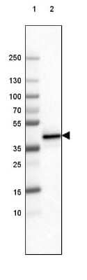 Western Blot: FCRN/FCGRT Antibody (CL3640) [NBP2-61627]