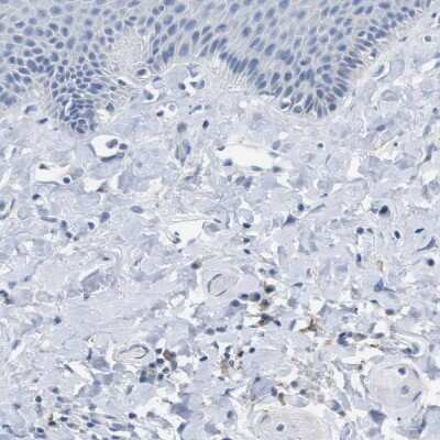 Immunohistochemistry-Paraffin: FCRN/FCGRT Antibody [NBP1-89127]