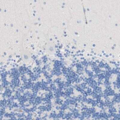 Immunohistochemistry-Paraffin: FCRN/FCGRT Antibody [NBP1-89128]