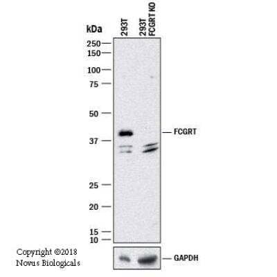 Knockout Validated: FCRN/FCGRT Antibody [NBP1-89128]