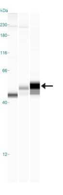 Simple Western: FCRN/FCGRT Antibody [NBP1-89128]