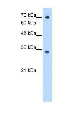 Western Blot: FCRN/FCGRT Antibody [NBP1-59061]