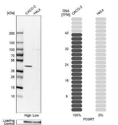 Western Blot: FCRN/FCGRT Antibody [NBP1-89128]