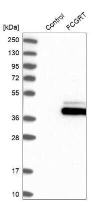 Western Blot: FCRN/FCGRT Antibody [NBP1-89128]