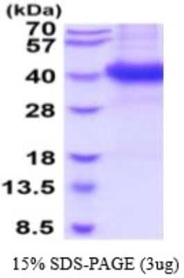 SDS-PAGE: Recombinant Mouse FCRN/FCGRT His Protein [NBP2-53082]