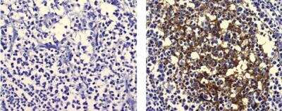 Immunohistochemistry-Paraffin: FDC Antibody (CNA.42) [NBP1-43118]