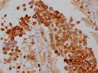 Immunohistochemistry: FDFT1 Antibody (10H12) [NBP3-15199]