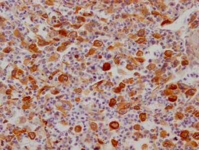 Immunohistochemistry: FDFT1 Antibody (10H12) [NBP3-15199]