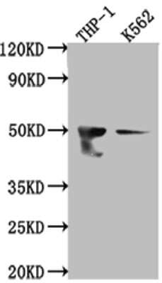 Western Blot: FDFT1 Antibody (10H12) [NBP3-15199]