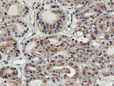Immunohistochemistry-Paraffin: FDFT1 Antibody (OTI2F10) [NBP2-01170]