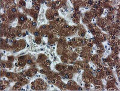 Immunohistochemistry-Paraffin: FDFT1 Antibody (OTI2F10) [NBP2-01170]