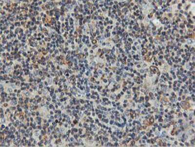 Immunohistochemistry-Paraffin: FDFT1 Antibody (OTI2F10) [NBP2-01170]
