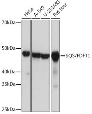 Western Blot: FDFT1 Antibody (4W10J4) [NBP3-16456]