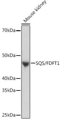 Western Blot: FDFT1 Antibody (4W10J4) [NBP3-16456]