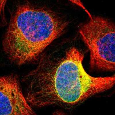Immunocytochemistry/ Immunofluorescence: FDFT1 Antibody [NBP1-89560]