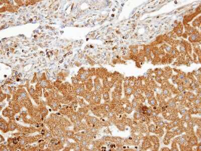 Immunohistochemistry-Paraffin: FDFT1 Antibody [NBP1-32147]