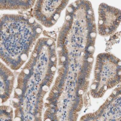 Immunohistochemistry-Paraffin: FDFT1 Antibody [NBP1-89560]