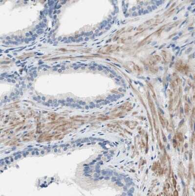 Immunohistochemistry-Paraffin: FDFT1 Antibody [NBP1-89560]