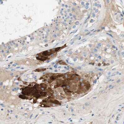 Immunohistochemistry-Paraffin: FDFT1 Antibody [NBP1-89560]