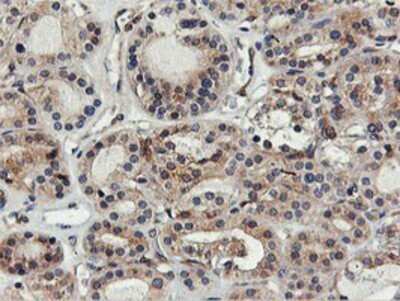 Immunohistochemistry: FDFT1 Antibody (OTI2F10) - Azide and BSA Free [NBP2-70715]
