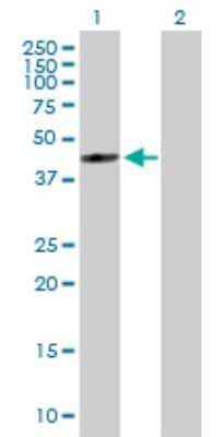 Western Blot: FDFT1 Antibody [H00002222-B01P]