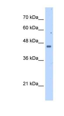 Western Blot: FDFT1 Antibody [NBP1-54855]