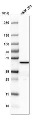 Western Blot: FDFT1 Antibody [NBP1-89560]