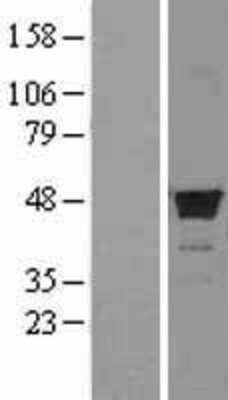 Western Blot: FDFT1 Overexpression Lysate [NBL1-10668]