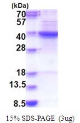 SDS-PAGE: Recombinant Human FDFT1 His Protein [NBP2-51801]