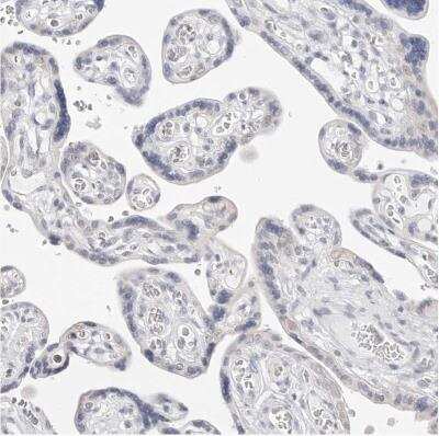 Immunohistochemistry-Paraffin: FDPS Antibody [NBP1-89509]