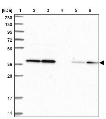 Western Blot: FDPS Antibody [NBP1-89509]