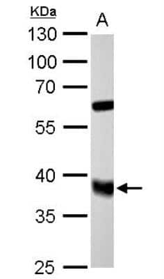 Western Blot: FDPS Antibody [NBP2-16463]