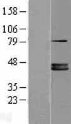 Western Blot: FDPS Overexpression Lysate [NBP2-04211]